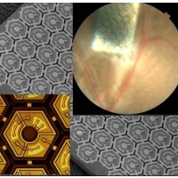 Retina solar cell implant